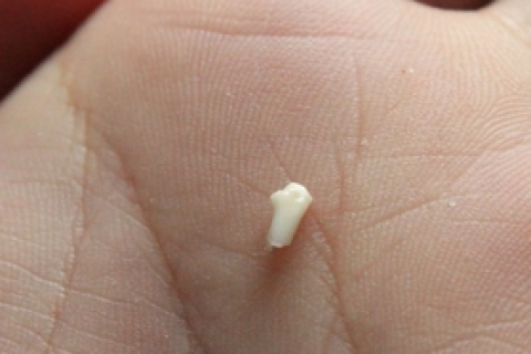 梦见自己的牙齿掉光，深层解析梦境背后的意义