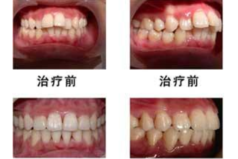 梦境解析，梦见自己牙齿松动并拔掉，寓意平安健康与家庭幸福