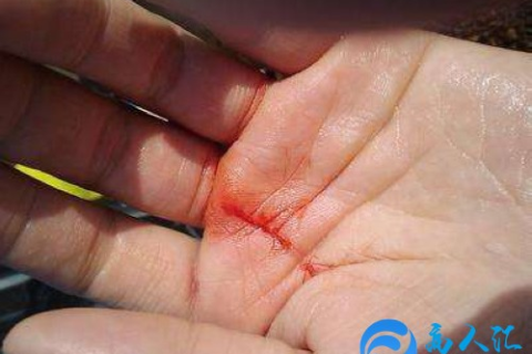 孕妇梦见自己流血了，梦境背后的深层含义与解读