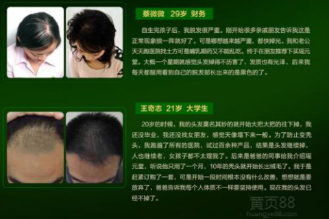 周公解梦，梦见自己秃头的深层含义与预兆