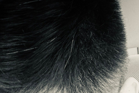 昨晚梦到自己头发白了一大块，在梦里我是真的很愰恐请问是？解读梦境中的预兆与心理映射