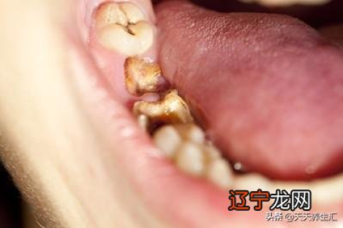梦见自己拔牙拔掉了，梦境背后的深层解析与心理启示