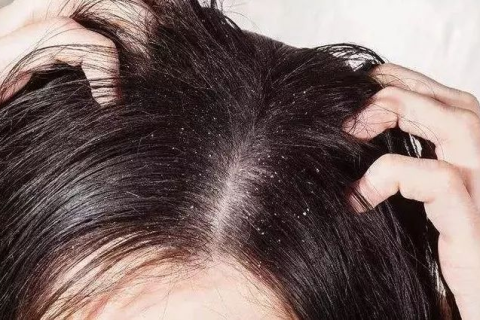 梦见把头发剪短了，预示生活新阶段的开始与自我重塑
