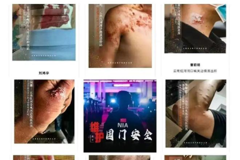 梦境解析，频繁梦见牙齿松动，探寻背后的深层含义