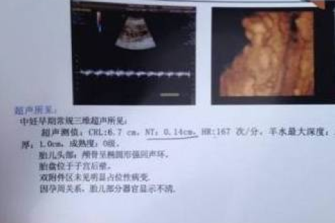 怀孕的人梦见宝宝做B超，梦境背后的寓意与心理解析