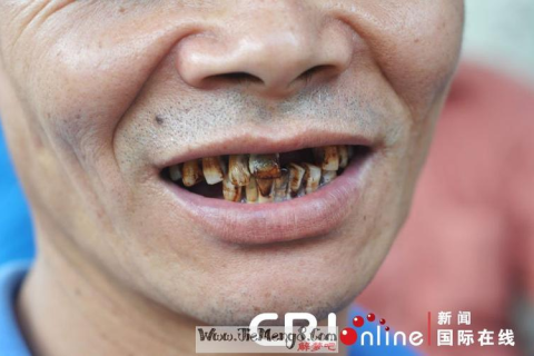 梦境解析，这段时间以来总是梦见掉牙一排一排的全掉光，意味着什么？