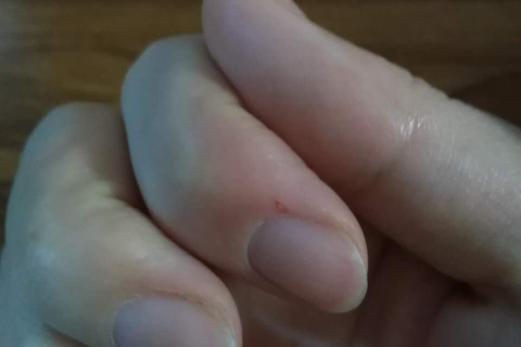 解析梦境中的警示，梦到牙流血意味着什么？