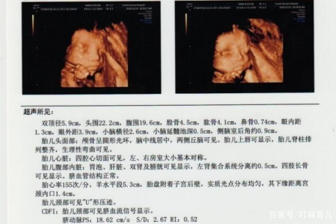 孕期梦境的奥秘，解析又梦见自己生了的深层含义