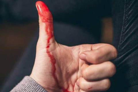 梦境中的暴力，解析梦见自己把别人打出血的深层含义