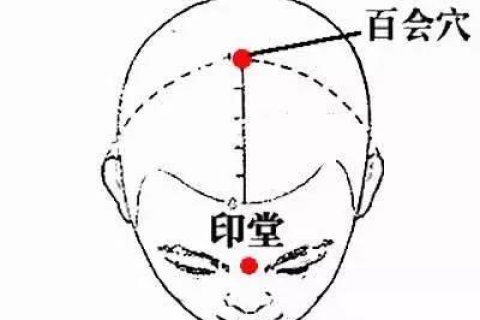 做梦梦到头发变白，梦境背后的深层含义与解析