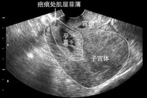 昨晚梦见自己怀孕了还差点流产流了好多血，梦境背后的深层含义与心理预兆解析