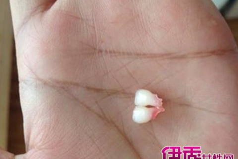 梦境解析，女人梦见掉牙齿的深层含义