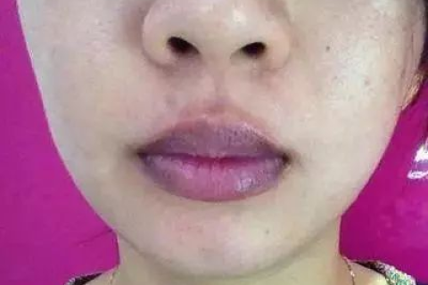产妇梦境解析，嘴唇先冒黑后冒血的深层含义