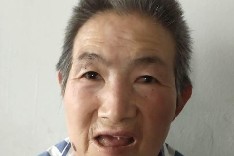 做梦梦见自己牙齿不停的脱落，梦境背后的深层预示与心理解析