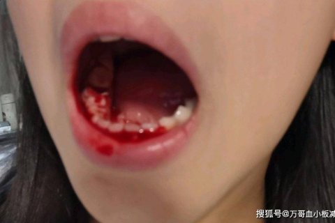 梦境解析，梦见自己下牙掉了一颗没出血，在此说破，家人身体健康平安