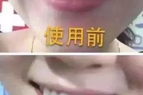 梦境解析，上下牙齿轻轻一合，咬碎无数——梦境背后的深层含义与心理解析