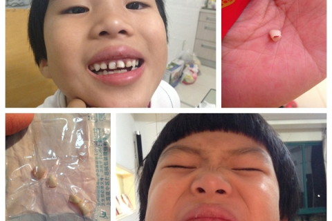 梦见牙脱落了，梦境背后的深层含义与心理解析