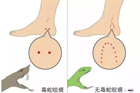 梦见被蛇咬伤右胸并出了大量的血，深层解析与心灵启示