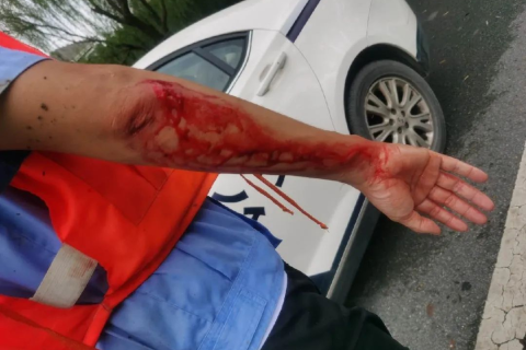 连续梦境的警示，亲兄弟离世与小臂流血的深层含义