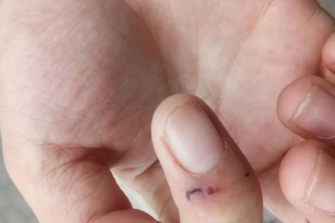 梦见老鼠咬我手指没出血我把老鼠掐出血了，梦境背后的深层解析与心理暗示