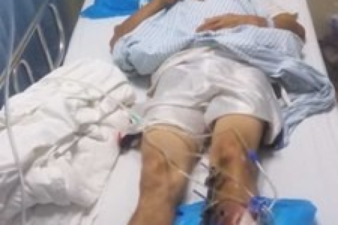 梦回往昔，解析梦到去世父亲出车祸腿受伤的深层含义