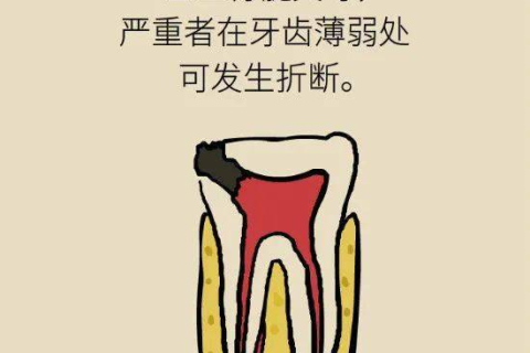 梦见掉牙很痛，探索梦境背后的深层含义与心理解析