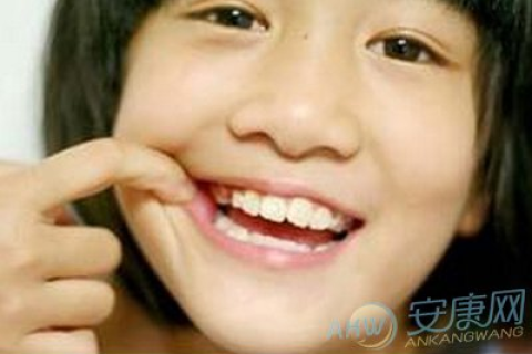 梦见自己牙齿松动快要掉了，梦境背后的深层含义与解析
