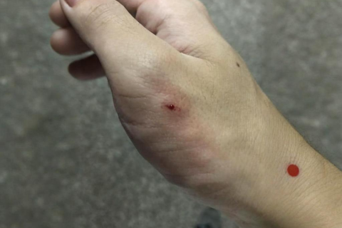 做梦梦见被狗咬在右手臂上没出血但有牙印，潜意识中的警示与自我反省