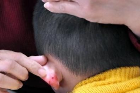 梦境中的警示，梦见老家哥打小孩子耳里出血的深层解析
