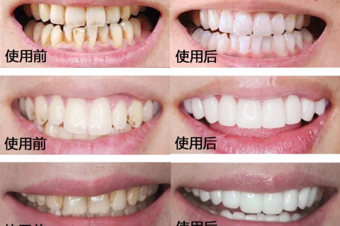 梦见牙齿掉落，深层解析与心理寓意