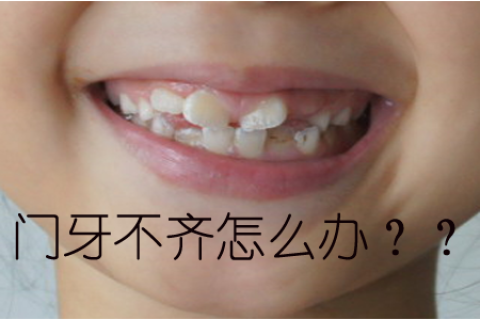 做梦梦到上面门牙左第三颗牙掉了不带根没出血，解读梦境背后的深层含义
