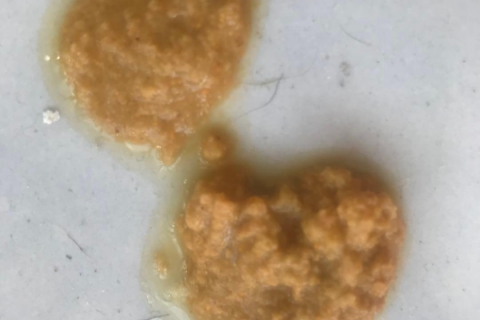 梦境与现实的交织，梦见怀孕却来月经的寓意解析