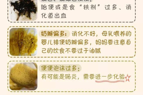 梦见大便裤子里面，解读梦境中的隐秘信息