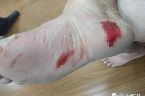 梦见自己脚底划破了流了好多血，探索梦境背后的深层含义