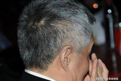 梦见自己白头发了是要戴孝吗？解读梦境中的预兆与心理暗示
