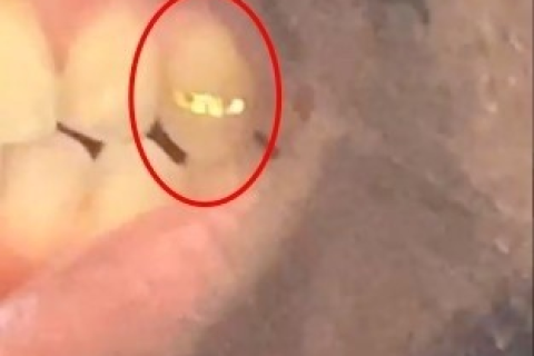 昨晚梦见掉了一颗牙齿特别的疼痛，寓意何为？