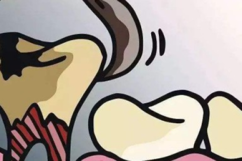 梦见牙痛拔牙，梦境背后的深层含义与心理解析