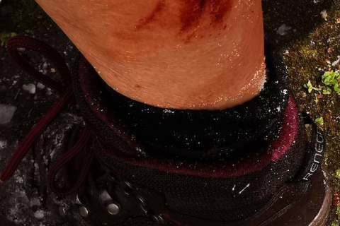 梦境解析，梦见自己双腿上被刻字与图案，未流血已结痂的深层含义