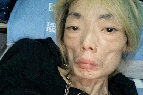 做梦梦到牙齿掉光好不好，梦境背后的深层含义与心理解析