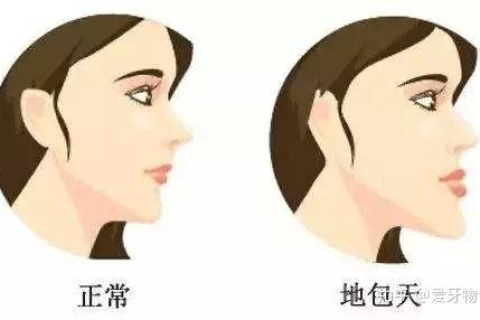 梦境的启示，梦见自己拔掉坏牙，寓意家庭健康与自我转变的预兆