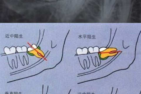 解析梦境，梦到牙齿从根掉了半块也没流血的深层含义